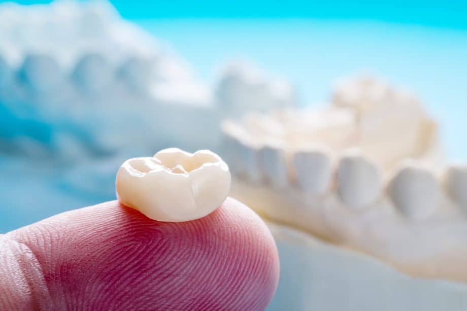How Much Is A Dental Crown In North Richland Hills, TX?